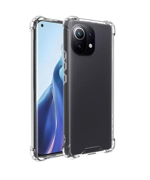 Unbreak Back Cover Σιλικόνης Διάφανο Για XIAOMI MI NOTE 10/NOTE 10 PRO